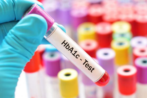 Photo: Close-up of lab technician's gloved hand holding A1c blood sample vial.